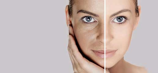 BEAUTY LASER