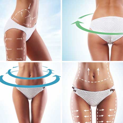BEAUTY LASER